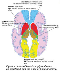 Anatomy of the Brain | Internet Stroke.
